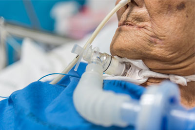 Complex Care Services at Home Complex Care Services at Home